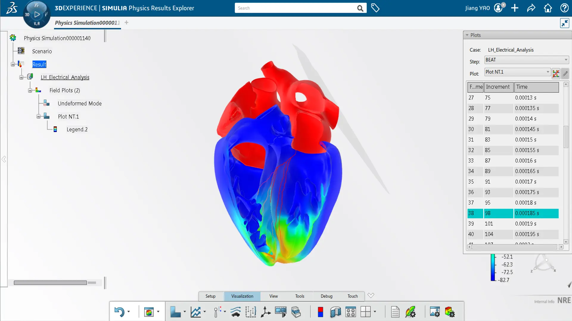 Electrical Analysis of a Human Heart with ABAQUS Simulation Technology